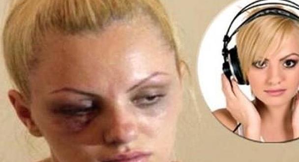 La Famosa y Hermosa cantante Alexandra Stan fue golpeada por su novio